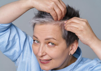 nonsurgical hair restoration