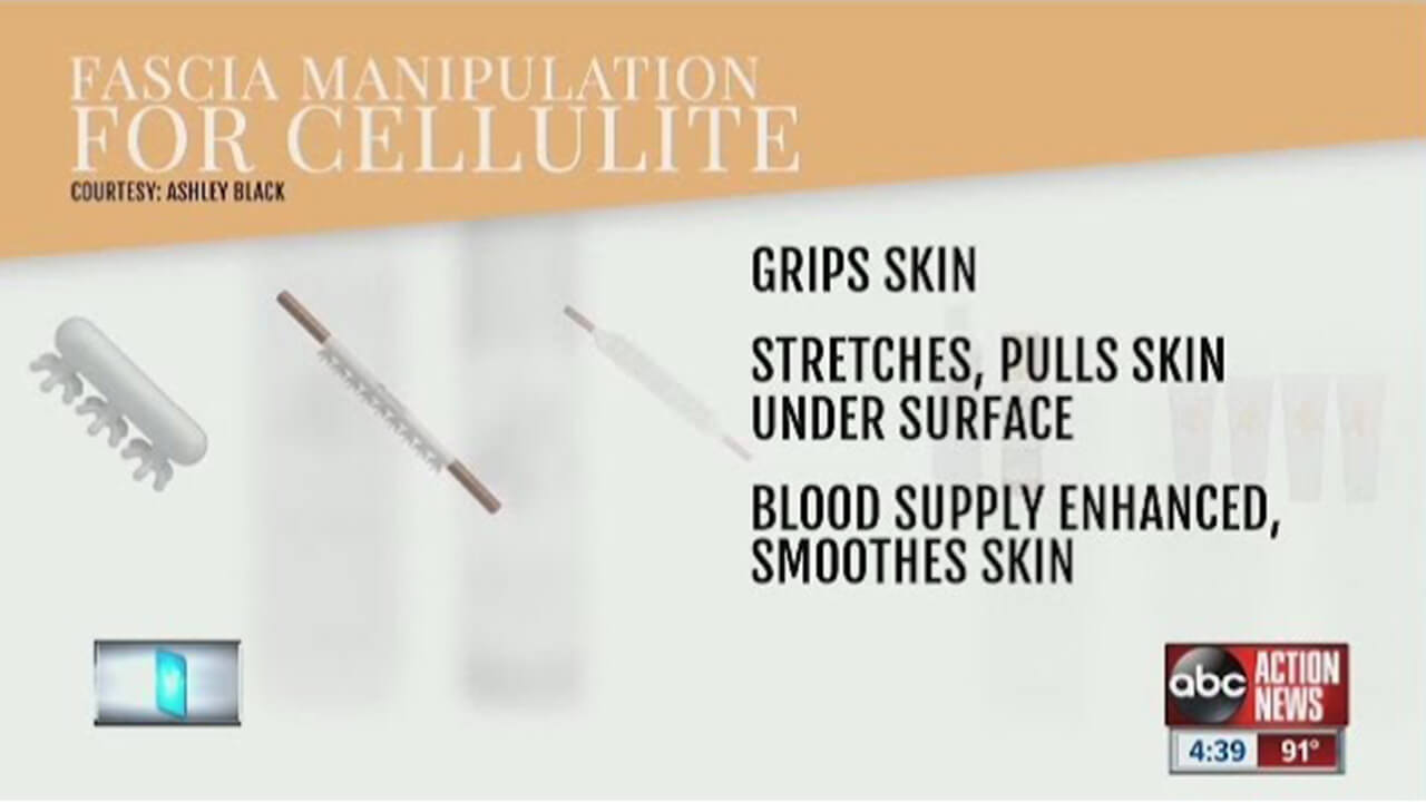 cellulite video