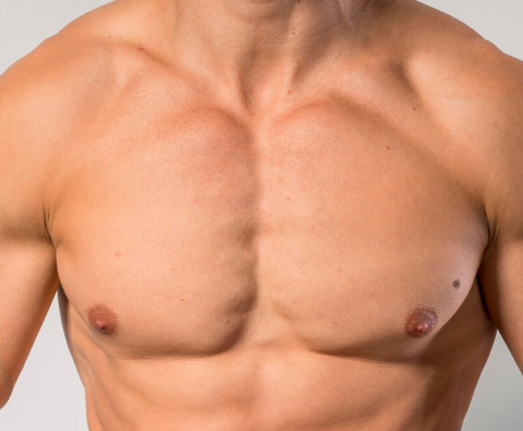 male breast reduction surgery