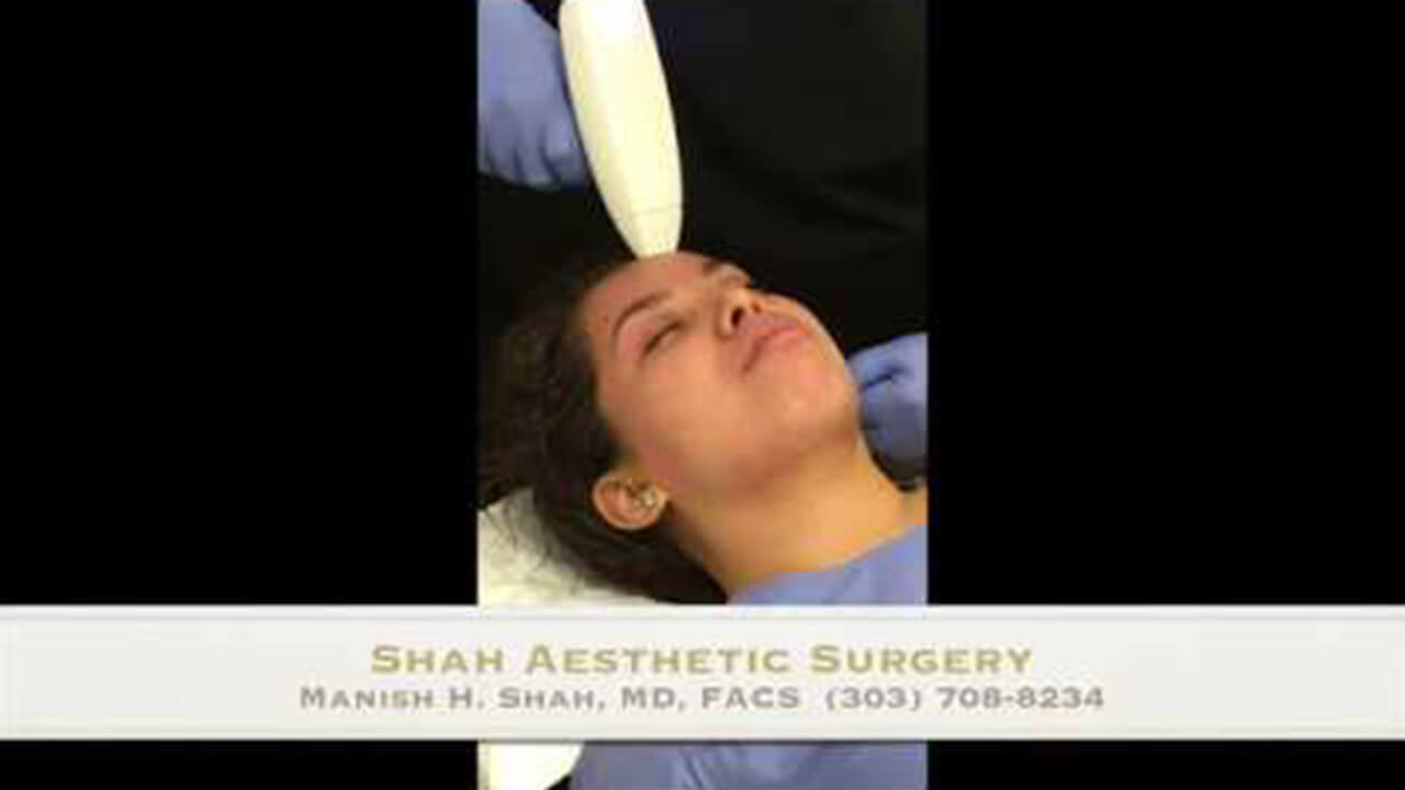 how to do ultrasonic rhinoplasty video